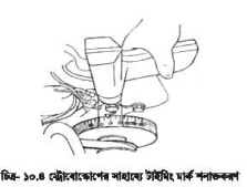 ইগনিশন টাইমিং